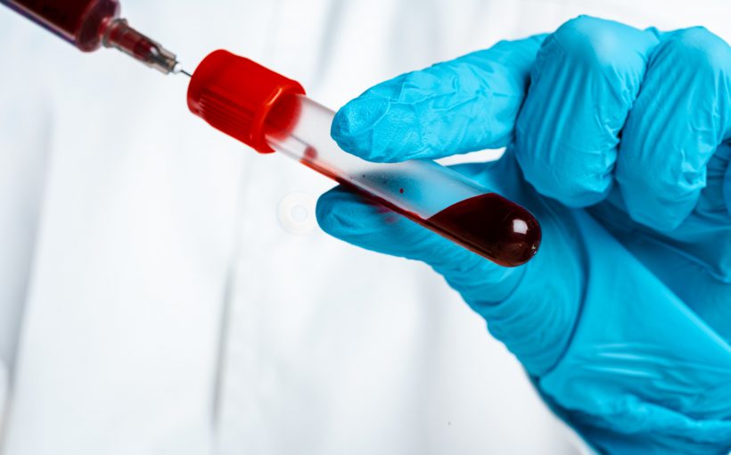 Lekarz w niebieskich rękawiczkach trzyma w rękach probówkę z krwią. Źródło: 123rf.com