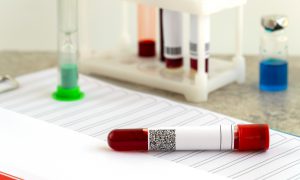 Fiolki z krwią pobraną w celu analizy laboratoryjnej. Źródło: 123rf.com