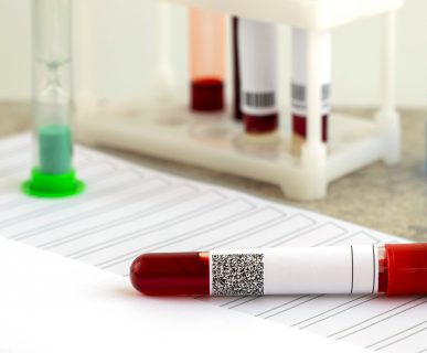 Fiolki z krwią pobraną w celu analizy laboratoryjnej. Źródło: 123rf.com