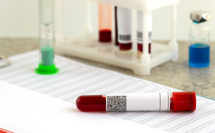 Fiolki z krwią pobraną w celu analizy laboratoryjnej. Źródło: 123rf.com
