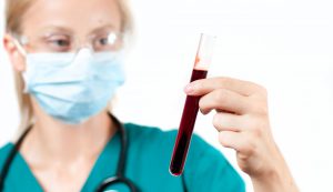 Pielęgniarka ubrania w sterylny strój trzyma w dłoni fiolkę z wcześniej pobraną krwią pacjenta do analizy.