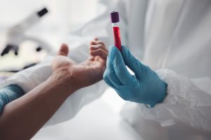Pielęgniarz w sterylnym stroju trzyma w dłoni fiolkę z próbką krwi pobraną pacjentowi.