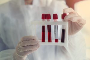 Pielęgniarz ubrany w sterylne ubranie trzyma w dłoniach odzianych w rękawiczki pobrane próbki krwi pacjentowi.