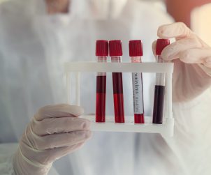 Pielęgniarz ubrany w sterylne ubranie trzyma w dłoniach odzianych w rękawiczki pobrane próbki krwi pacjentowi. Źródło: 123rf.com
