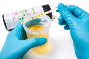 Analityk laboratoryjny sprawdza właściwości moczu. /Źródło: 123rf.com