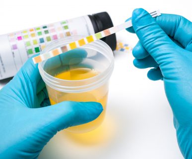 Analityk laboratoryjny sprawdza właściwości moczu. /Źródło: 123rf.com