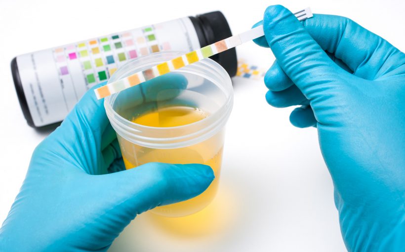 Analityk laboratoryjny sprawdza właściwości moczu. /Źródło: 123rf.com