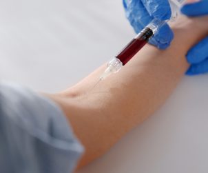 Pacjentowi pobierana jest krew z żyły ręki przez doświadczonego pielęgniarza. Źródło: 123rf.com