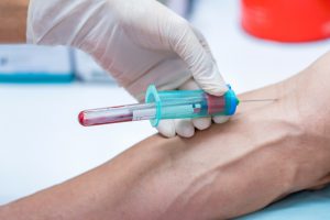 Pielęgniarz w rękawiczkach wkłuwa się w żyłę pacjenta w celu pobraniu krwi do diagnostyki laboratoryjnej.