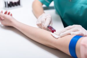 Pielęgniarka pobierająca krew z żyły pacjenta do badania laboratoryjnego.