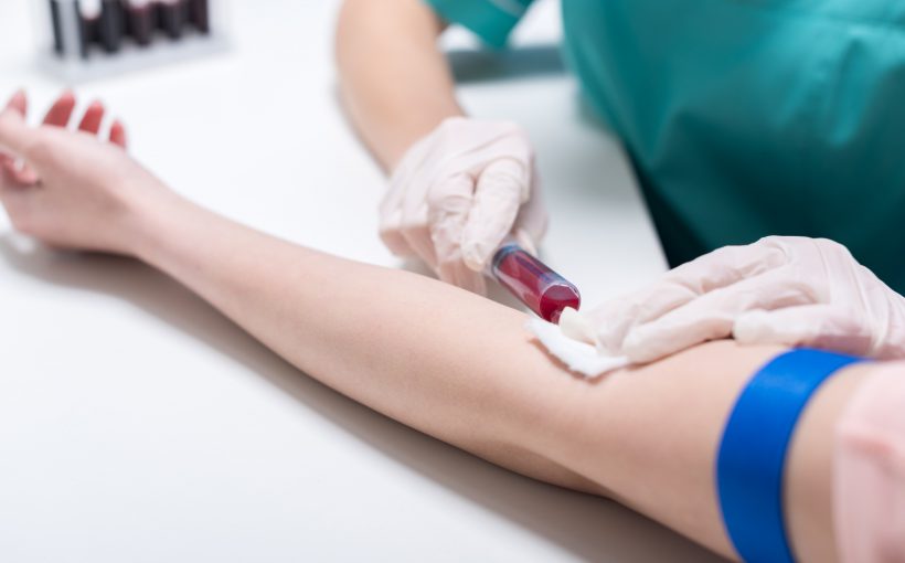 Pielęgniarka pobierająca krew z żyły pacjenta do badania laboratoryjnego. Źródło: 123rf.com