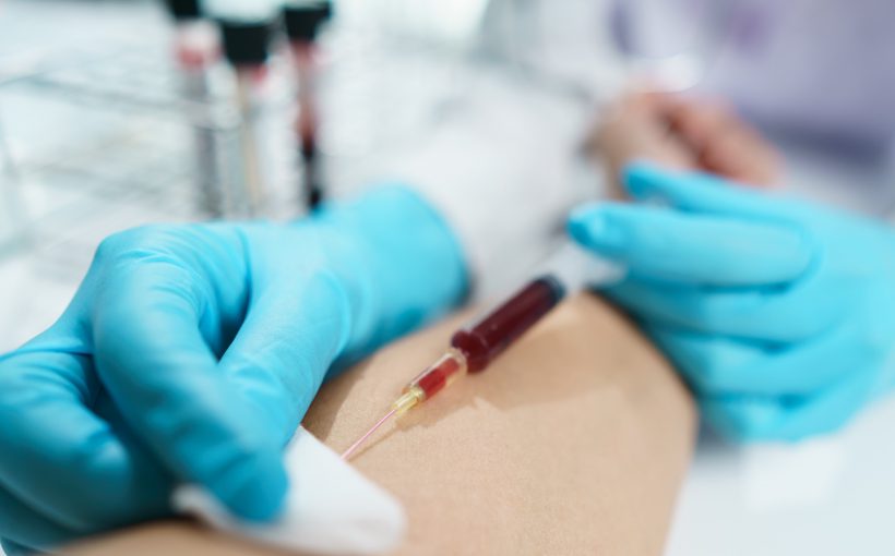 Pielęgniarka w sterylnych rękawiczkach pobiera pacjentowi próbkę krwi do dalszej diagnostyki laboratoryjnej. Źródło: 123rf.com