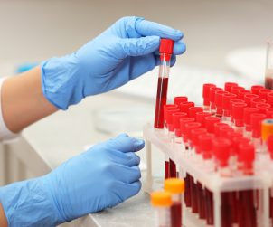 Scientist working with blood sample in laboratory