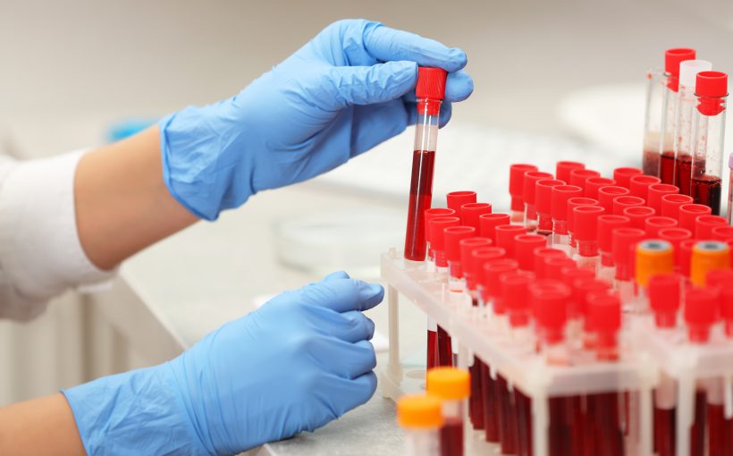Scientist working with blood sample in laboratory