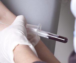 Real drawing blood procedure in medical laboratory