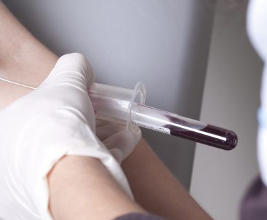 Real drawing blood procedure in medical laboratory