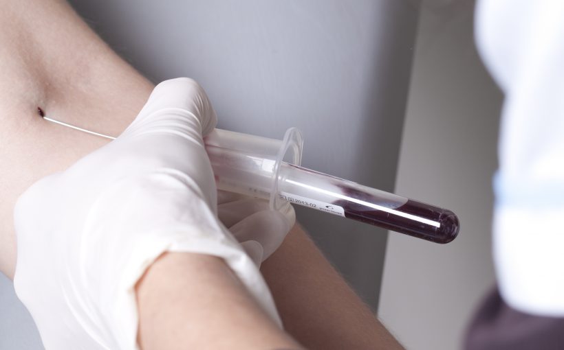 Real drawing blood procedure in medical laboratory