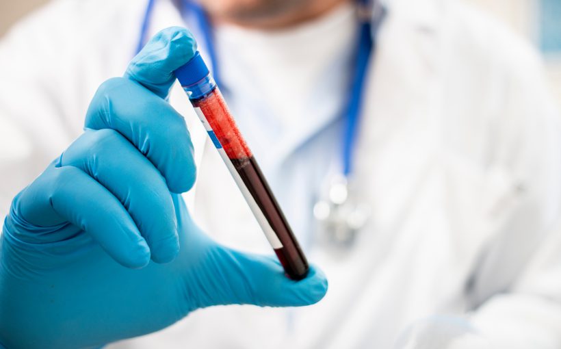 View of a doctor holding a fictional test tube blood sample, possibly infected.