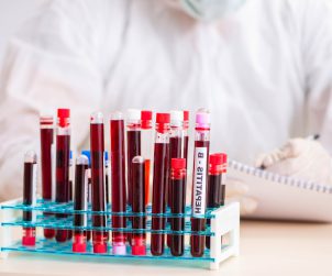 The young handsome lab assistant testing blood samples in hospital