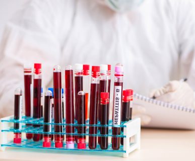 The young handsome lab assistant testing blood samples in hospital