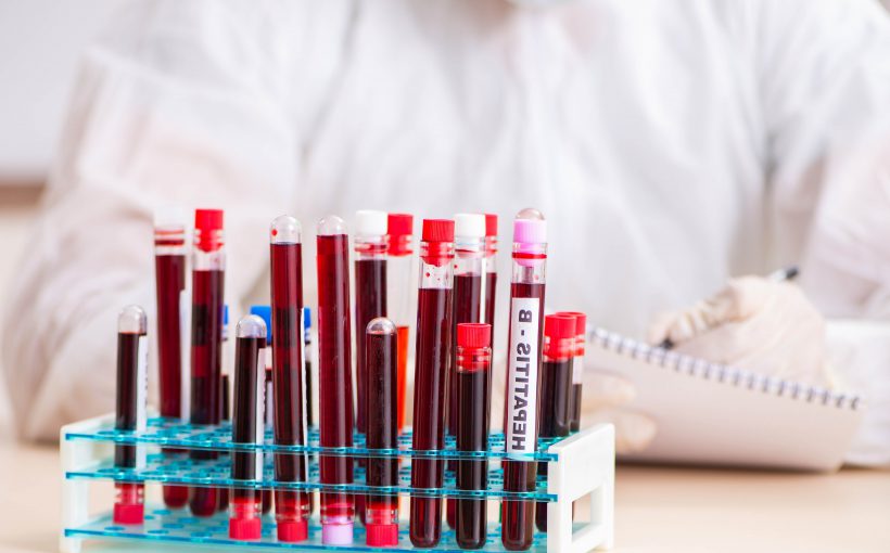 The young handsome lab assistant testing blood samples in hospital