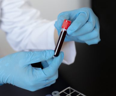 Scientists or doctors collect blood samples from new strains of virus patients for analysis and vaccination in the research laboratory, Vaccine research to eliminate viruses concept.