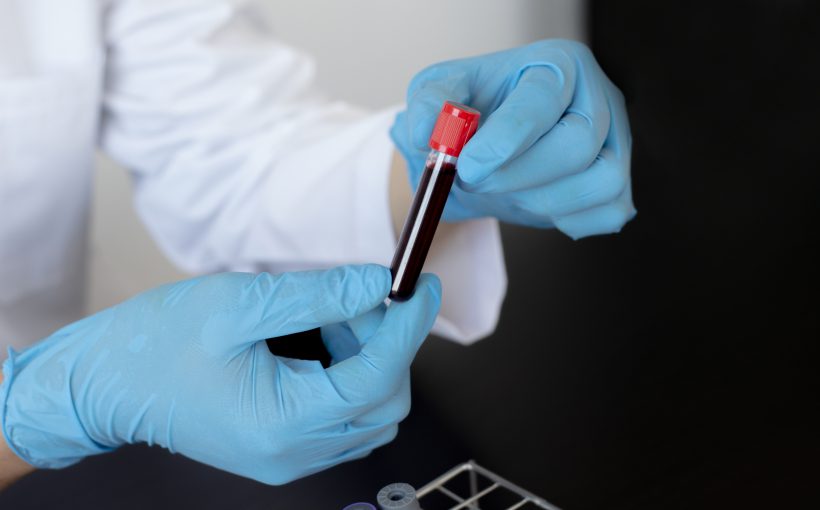 Scientists or doctors collect blood samples from new strains of virus patients for analysis and vaccination in the research laboratory, Vaccine research to eliminate viruses concept.