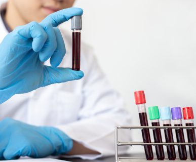 Scientists or doctors collect blood samples from new strains of virus patients for analysis and vaccination in the research laboratory, Vaccine research to eliminate viruses concept.