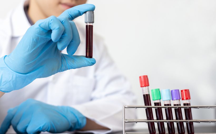 Scientists or doctors collect blood samples from new strains of virus patients for analysis and vaccination in the research laboratory, Vaccine research to eliminate viruses concept.
