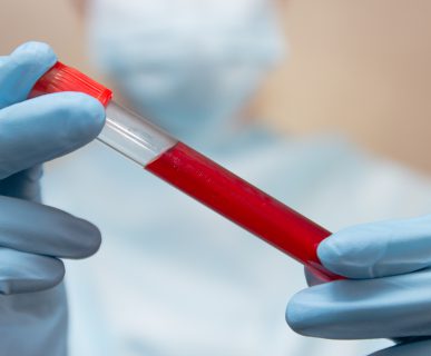 Doctor in protective suit, medical mask and latex gloves holds a test tube with blood.