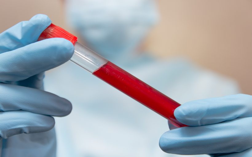 Doctor in protective suit, medical mask and latex gloves holds a test tube with blood.