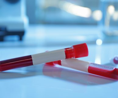 Test tubes with blood samples on table in laboratory
