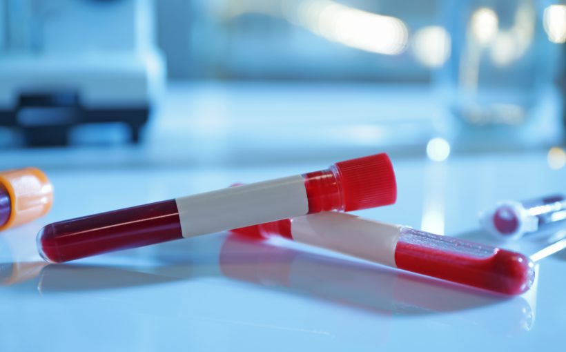 Test tubes with blood samples on table in laboratory