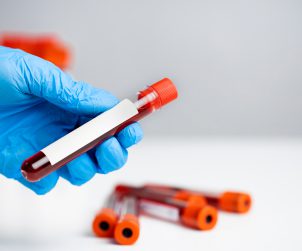 Technician holding blood tube test in the research laboratory.