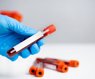 Technician holding blood tube test in the research laboratory.