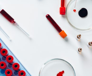 Blood test analysis with Petri dish close up