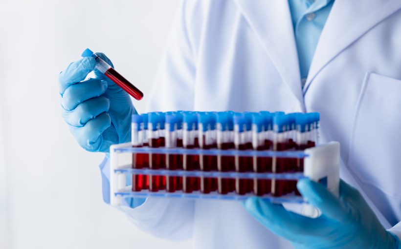 Lab assistant, a medical scientist, a chemistry researcher holds a glass tube through the blood sample, does a chemical experiment and examines a patient's blood sample. Medicine and research concept.