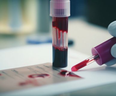 Blood test in a laboratory. Blood samples in test tubes. Medical background.