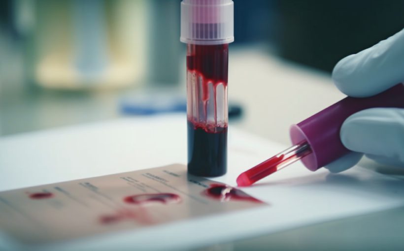 Blood test in a laboratory. Blood samples in test tubes. Medical background.