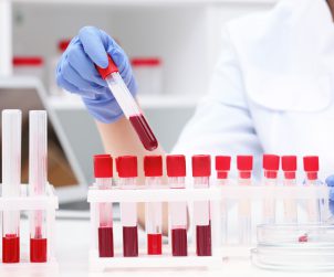 Scientist working with blood samples in test tubes at table