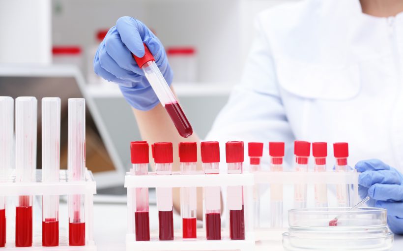 Scientist working with blood samples in test tubes at table