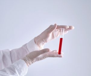 Test tube with blood in the hand of a medical worker.