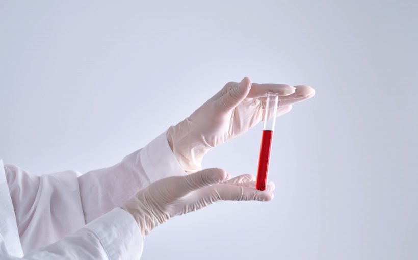 Test tube with blood in the hand of a medical worker.