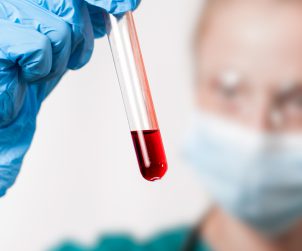 Female doctor doing the blood test in medical laboratory