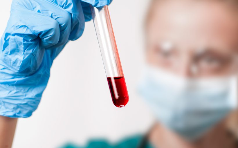Female doctor doing the blood test in medical laboratory