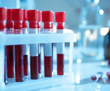 Test tubes with blood samples on table in laboratory, closeup