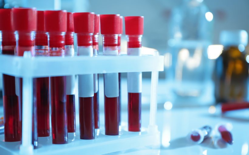 Test tubes with blood samples on table in laboratory, closeup
