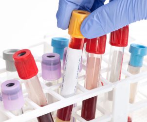 Blood analysis collection tube selected by lab technician. Labels and document are fictitious and created by the photographer.