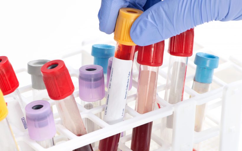 Blood analysis collection tube selected by lab technician. Labels and document are fictitious and created by the photographer.