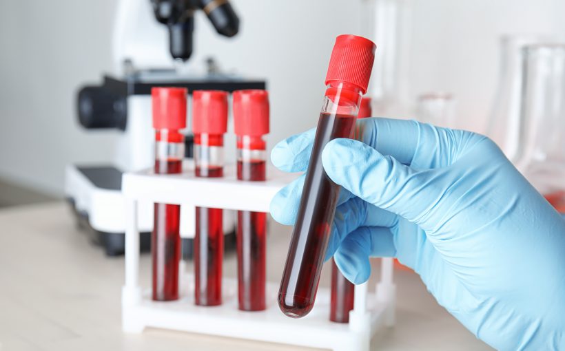 Scientist taking test tube with blood sample from rack at table, closeup. Laboratory analysis